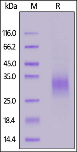 ACROBiosystems ACROBiosystems Cynomolgus NKG2A / CD159a Protein, His Tag,