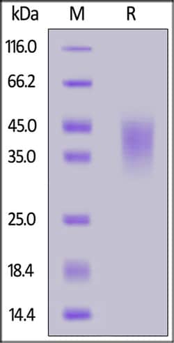 ACROBiosystems ACROBiosystems Mouse NKG2A / CD159a Protein, His Tag, Quantity: