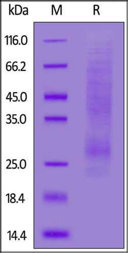 ACROBiosystems Cynomolgus NKG2C / CD159c Protein, His Tag, Quantity: Each