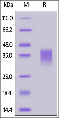 ACROBiosystems Human NKG2C / CD159c Protein, His Tag, Quantity: Each of