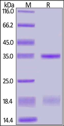ACROBiosystems SARS-CoV-2 (COVID-19) NSP16&NSP10 Heterodimer Protein, His