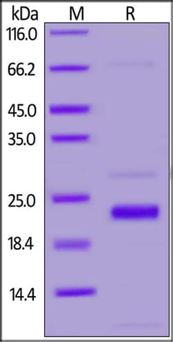 ACROBiosystems SARS-CoV-2 (COVID-19) NSP1 Protein, His Tag, Quantity: Each