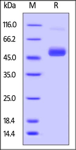 ACROBiosystems ACROBiosystems Biotinylated Zika virus NS1 Protein, Avitag
