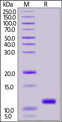 ACROBiosystems SARS-CoV-2 (COVID-19) NSP7 Protein, His Tag (MALS verified),