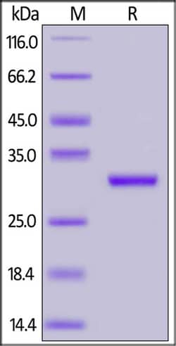 ACROBiosystems SARS-CoV-2 (COVID-19) NSP7&NSP8 Protein, His Tag, Quantity: