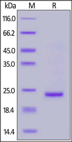 ACROBiosystems SARS-CoV-2 (COVID-19) NSP8 Protein, His Tag, Quantity: Each