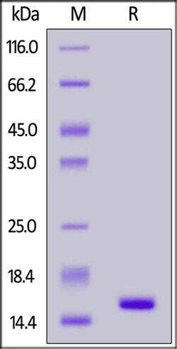 ACROBiosystems ACROBiosystems SARS-CoV-2 Nucleocapsid Protein NTD, His