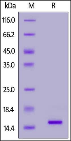 ACROBiosystems ACROBiosystems SARS-CoV-2 Nucleocapsid Protein CTD, His