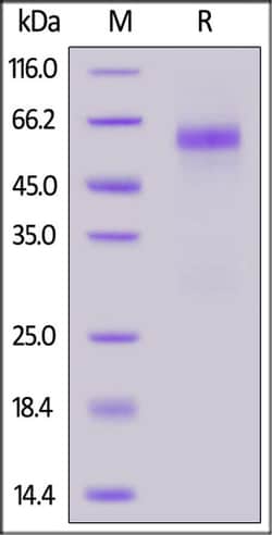 ACROBiosystems ACROBiosystems SARS-CoV-2 Nucleocapsid protein (R203M, D377Y),