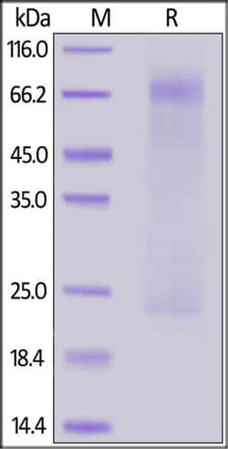 ACROBiosystems MERS Nucleocapsid protein, His Tag, Quantity: Each of 1