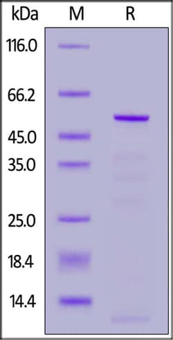 ACROBiosystems HCoV-OC43 Nucleocapsid protein, His Tag, Quantity: Each