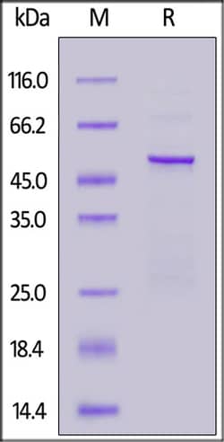 ACROBiosystems HCoV-229E Nucleocapsid protein, His Tag, Quantity: Each