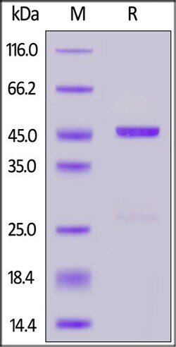 ACROBiosystems Onchocerca volvulus OV16 protein, GST Tag, Quantity: Each