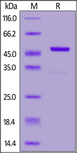 ACROBiosystems Biotinylated Onchocerca volvulus OV16 protein, Avi,GST Tag,
