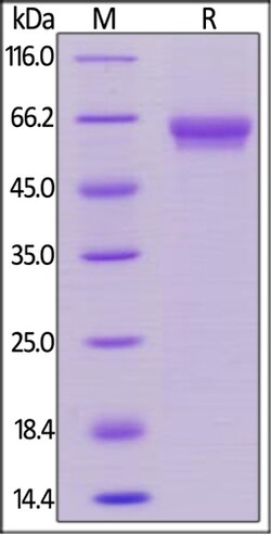 ACROBiosystems ACROBiosystems Human OX40 / TNFRSF4 / CD134 Protein, Mouse