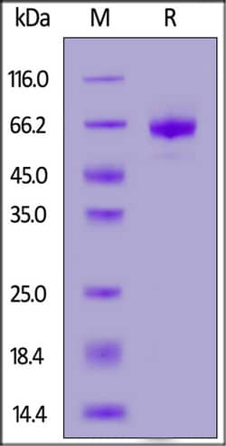 ACROBiosystems ACROBiosystems Human OX40 / TNFRSF4 / CD134 Protein, Fc