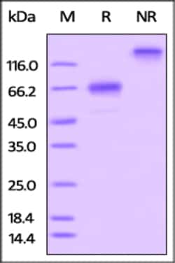 ACROBiosystems Rat OX40 / TNFRSF4 / CD134 Protein, Fc Tag, Quantity: Each