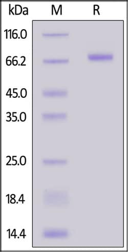 ACROBiosystems ACROBiosystems Biotinylated Mouse CD200 / OX-2 Protein,
