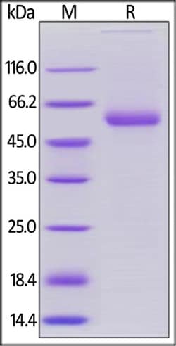 ACROBiosystems ACROBiosystems Human OX40 Ligand / TNFSF4 Protein, Mouse
