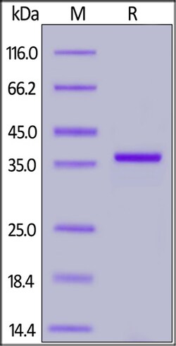 ACROBiosystems&nbsp;SARS-CoV-2 (COVID-19) Papain-like Protease Protein, His Tag