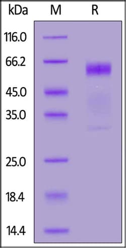 ACROBiosystems ACROBiosystems Human PD-1 Protein, His tag (Nanoparticle),