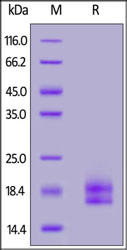 ACROBiosystems ACROBiosystems Human PD-L1 / B7-H1 (19-134) Protein, His