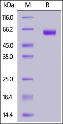 ACROBiosystems ACROBiosystems Biotinylated Human PD-1 / PDCD1 Protein,