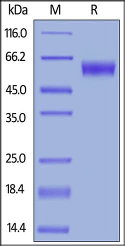 ACROBiosystems ACROBiosystems Mouse PD-1 / PDCD1 Protein, Fc Tag, Quantity: