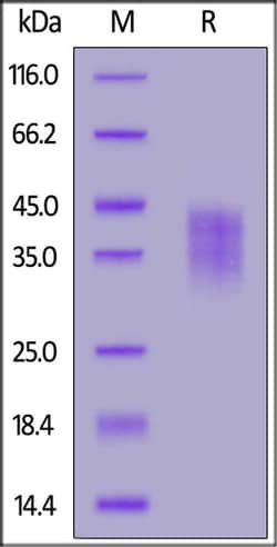 ACROBiosystems ACROBiosystems Rhesus macaque PD-1 / PDCD1 Protein, His