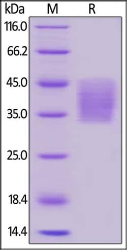 ACROBiosystems ACROBiosystems Human PD-L2 / B7-DC Protein, His Tag (SPR