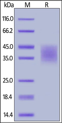 ACROBiosystems ACROBiosystems Biotinylated Human PD-L2 / B7-DC Protein,