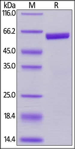 ACROBiosystems ACROBiosystems Biotinylated Human Prolactin / PRL Protein,