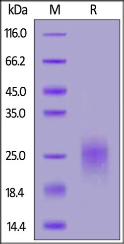 ACROBiosystems Biotinylated Human PSCA Protein, His,Avitag, Quantity: Each