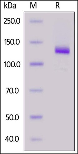 ACROBiosystems ACROBiosystems Human PTK7 / CCK4 Protein, Fc Tag, Quantity: