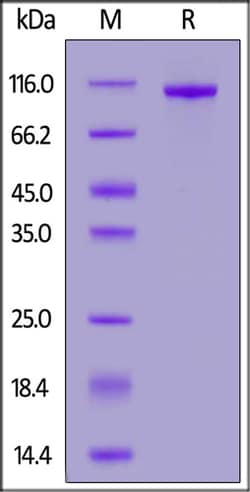 ACROBiosystems Human PTK7 / CCK4 Protein, His Tag, Quantity: Each of 1