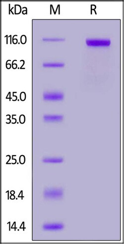 ACROBiosystems Biotinylated Human PTK7 / CCK4 protein, His,Avitag, Quantity: