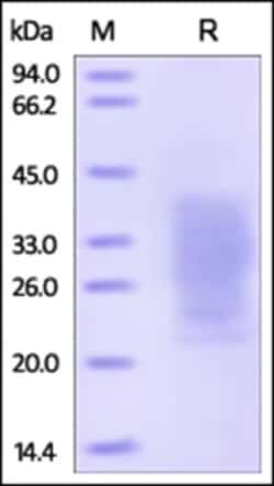 ACROBiosystems ACROBiosystems Human PTH1R / PTHR1 Protein, His Tag, Quantity: