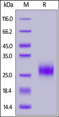 ACROBiosystems ACROBiosystems Human / Cynomolgus / Rhesus macaque ROR1