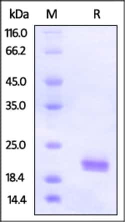 ACROBiosystems Human ROR1 (308-395, Kringle domain) Protein, His Tag, Quantity: