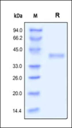 ACROBiosystems Recombinant Protein;Human R-Spondin 1 / RSPO1 Protein;HEK293;50UG;RS1,RSPO1,RSPO-1,CRISTIN3,CRISTIN-3,FLJ40906,RP11-566C13.1,RSPO,R-spondin-1,Rspondin-1,Rspondin1,Rspondin,