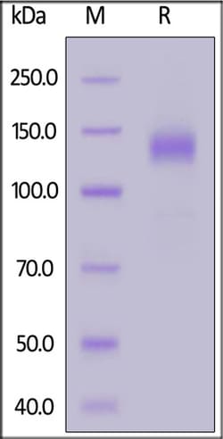 ACROBiosystems ACROBiosystems SARS-CoV-2 S1 protein (L18F, T20N, P26S,
