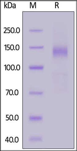 ACROBiosystems ACROBiosystems SARS-CoV-2 S1 protein (L18F, D80A, D215G,
