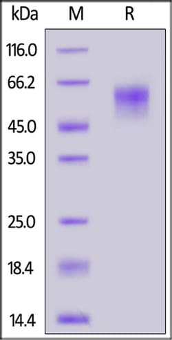 ACROBiosystems ACROBiosystems SARS-CoV-2 S1 protein NTD (L18F, D80A, D215G,