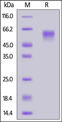 ACROBiosystems ACROBiosystems SARS-CoV-2 Spike NTD (T19R, G142D, EF156-157del,