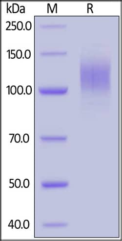 ACROBiosystems 100UG 2019-NCOV COVID-19 S1, Quantity: Each of 1