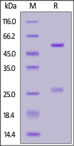 ACROBiosystems ACROBiosystems Biotinylated Anti-SARS-CoV-2 Spike RBD Antibody,