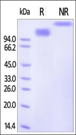 ACROBiosystems ACROBiosystems Human SCARB1 / SR-B1 Protein, Fc Tag, Quantity:
