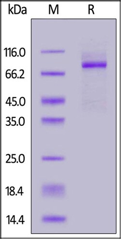 ACROBiosystems ACROBiosystems Human Secretory Component, Twin Strep Tag,
