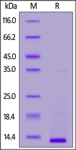 ACROBiosystems ACROBiosystems Human SDF-1 / CXCL12 Protein, His Tag, Quantity: