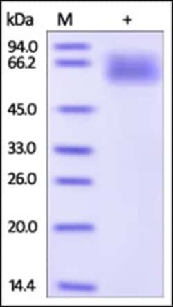 ACROBiosystems ACROBiosystems Human Serpin A3 Protein, His Tag, Quantity: